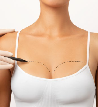 Breast