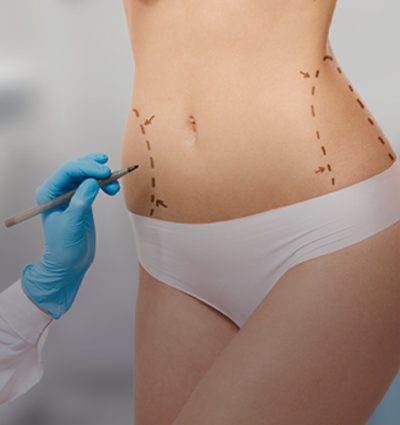 Scarless Surgery