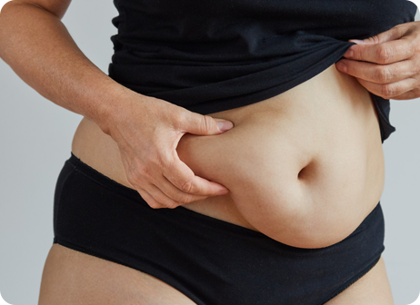 Arm Lift (Abdominoplasty)