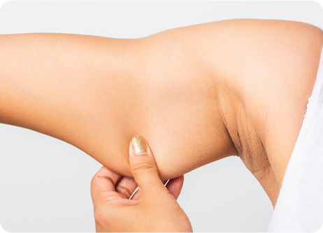 Arm Lift (Brachioplasty)