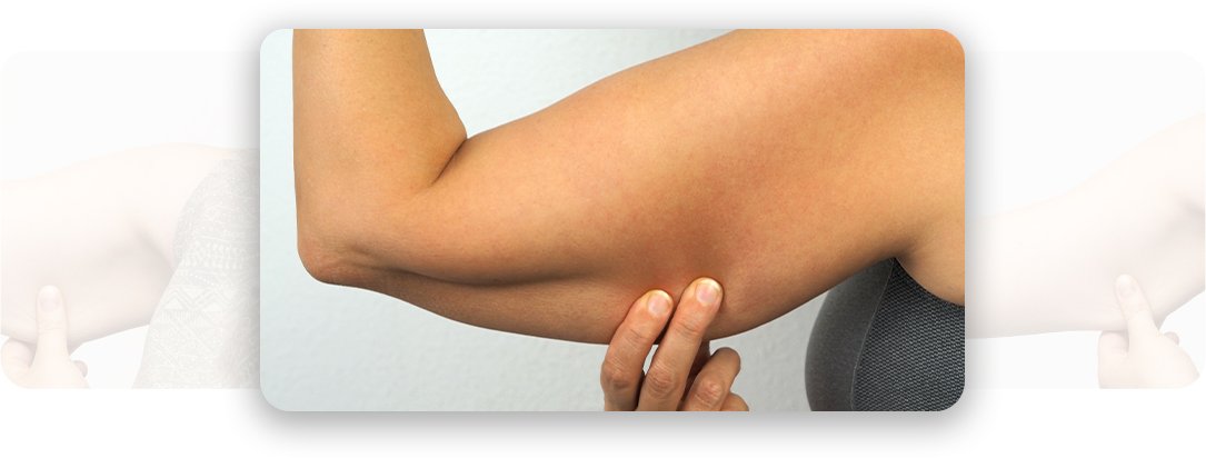 Brachioplasty - AEONA Aesthetic Clinic