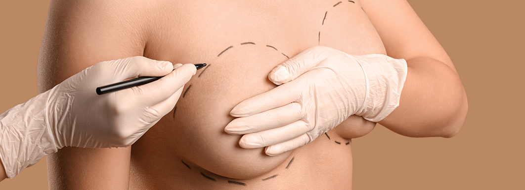 Optimized Responsive Image