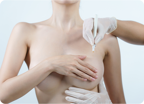 Scarless Breast Reduction