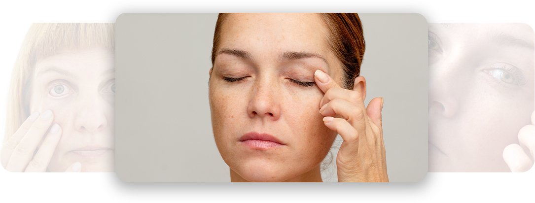 Blepharoplasty - AEONA Aesthetic Clinic