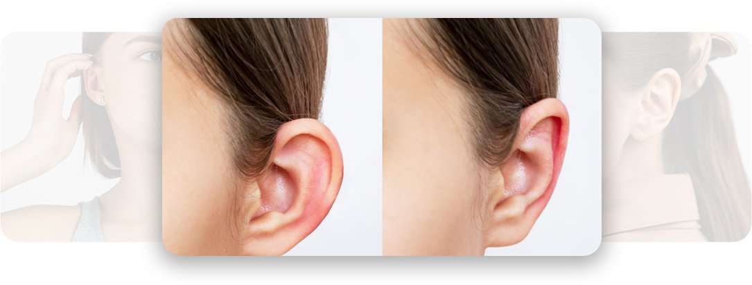 Ear Surgery - AEONA Aesthetic Clinic