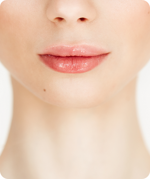 Lip Lift Surgery Procedures