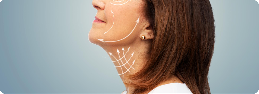 Necklift Techniques