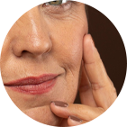 Restoring volume to sunken