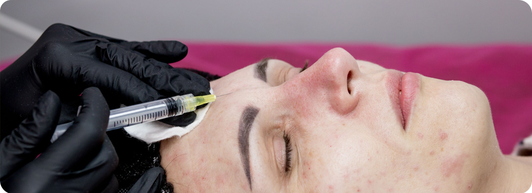 Brachioplasty Techniques