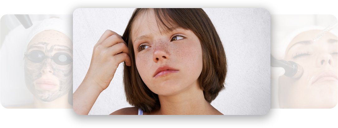 Teenage Rejuvenation - AEONA Aesthetic Clinic