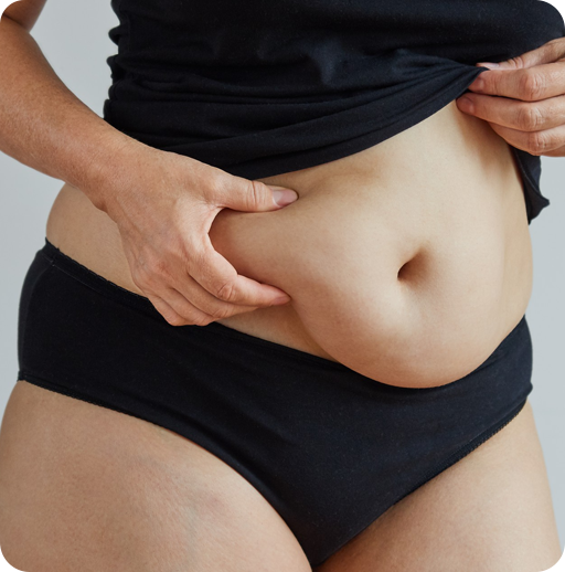 Why Women Choose Tummy Tuck?