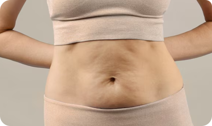 Tummy Tuck Procedure