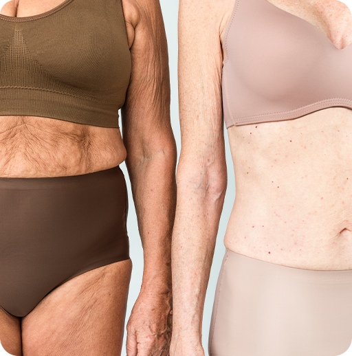 Why Women Choose Post Weight loss Treatment?